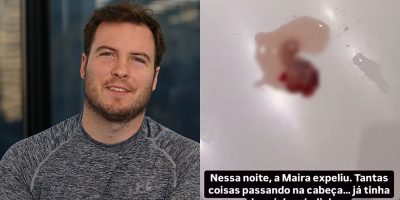 nigro feto