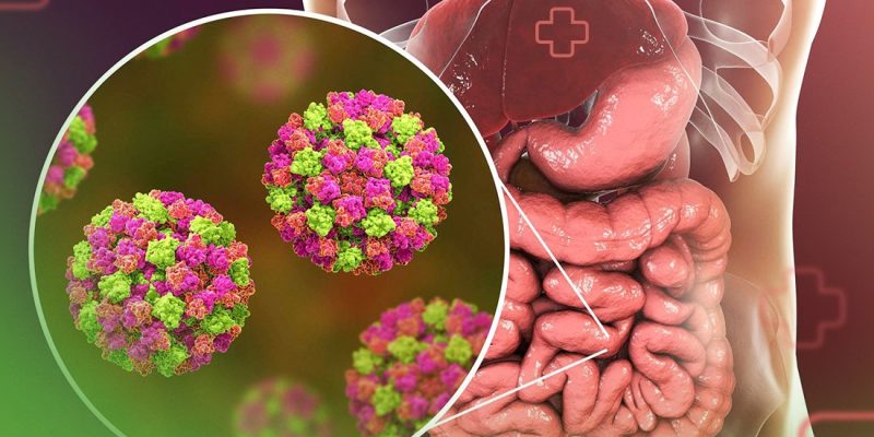 norovirus