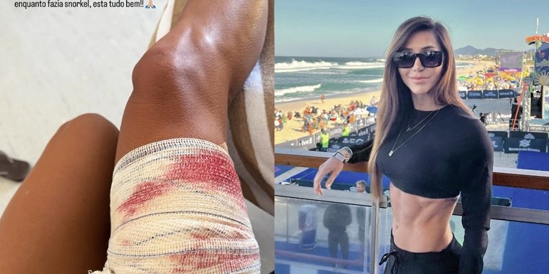 turista mordida tubarão noronha